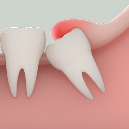 Công ty TNHH Thương mại Diên Niên